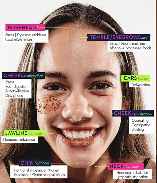 Acne Mapping skincare